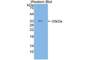 Detection of Recombinant TIEG1, Mouse using Polyclonal Antibody to TGF Beta Inducible Early Response Gene 1 (TIEG1) (KLF10/TIEG1 Antikörper  (AA 206-473))