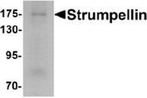 Western blot analysis of Strumpellin in human ovary tissue lysate with Strumpellin Antibody  at 1 μg/ml.