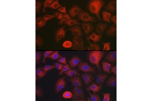 Immunofluorescence (IF) image for anti-Myosin X (MYO10) (AA 845-944) antibody (ABIN6144271)