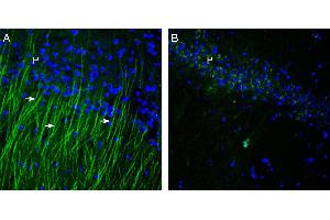 Immunohistochemistry (IHC) image for anti-Transient Receptor Potential Cation Channel, Subfamily M, Member 6 (TRPM6) (AA 802-815), (Extracellular) antibody (ABIN7043835)