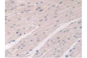 IHC-P analysis of Mouse Heart Tissue, with DAB staining. (DDX58 Antikörper  (AA 1-211))