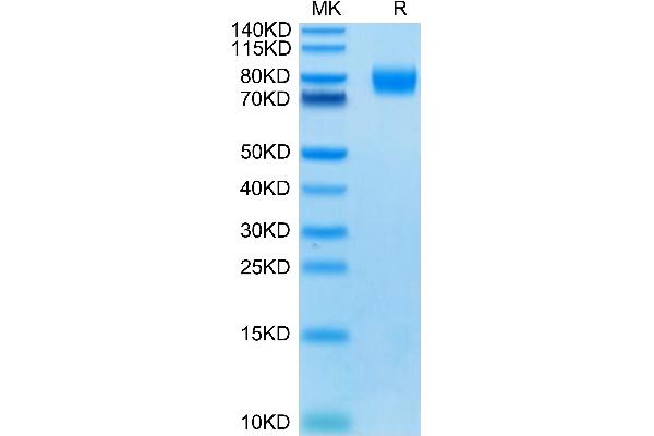 Poliovirus Receptor Protein (PVR) (AA 21-343) (mFc Tag)