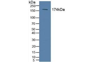 Detection of ABCC2 in Human Serum using Polyclonal Antibody to ATP Binding Cassette Transporter C2 (ABCC2) (ABCC2 Antikörper  (AA 1300-1534))