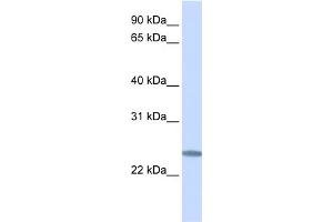 WB Suggested Anti-C12orf49 Antibody Titration:  0. (C12orf49 Antikörper  (C-Term))