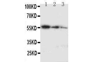 Lane 3: Recombinant Human Ki67 Protein 2. (Ki-67 Antikörper  (C-Term))