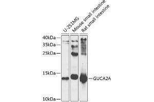 Western blot analysis of extracts of various cell lines, using GUCA antibody (ABIN6127993, ABIN6141529, ABIN6141530 and ABIN6225126) at 1:1000 dilution. (GUCA2A Antikörper  (AA 22-115))