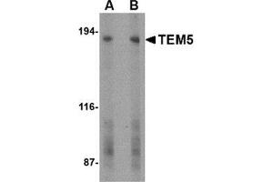 Western blot analysis of TEM5 in human bladder tissue lysate with this product at (A) 2 and (B) 4 μg/ml. (GPR124 Antikörper  (C-Term))