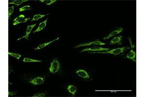 Immunofluorescence (IF) image for anti-Heat Shock 60kDa Protein 1 (Chaperonin) (HSPD1) (AA 1-573) antibody (ABIN947996)