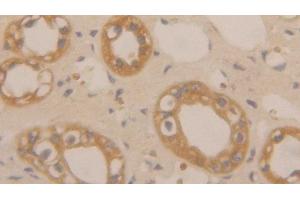 Detection of CLC in Human Kidney Tissue using Polyclonal Antibody to Charcot Leyden Crystal Protein (CLC) (Galectin 10 Antikörper  (AA 2-142))