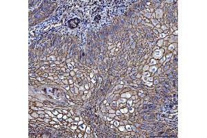 IHC analysis of CD147/Emmprin using anti-CD147/Emmprin antibody (ABIN7599999). (CD147 Antikörper  (AA 138-323))