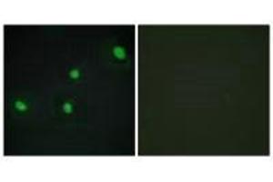 Immunofluorescence analysis of HepG2 cells, using CDCA4 antibody.