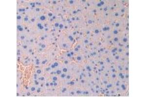 IHC-P analysis of Mouse Liver Tissue, with DAB staining. (CD47 Antikörper  (AA 18-219))
