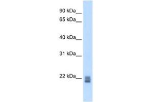 Western Blotting (WB) image for anti-Regulator of G-Protein Signaling 1 (RGS1) antibody (ABIN2462642)