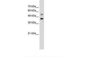 Image no. 1 for anti-GTP Binding Protein 2 (GTPBP2) (AA 511-560) antibody (ABIN203420) (GTPBP2 Antikörper  (AA 511-560))