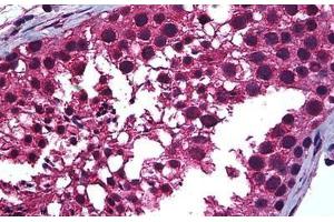Human Testis: Formalin-Fixed, Paraffin-Embedded (FFPE) (Retinoic Acid Receptor alpha Antikörper  (AA 1-463))