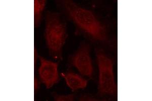Immunofluorescence staining of methanol-fixed Hela cells using Phospho-DOK2-Y299 antibody.