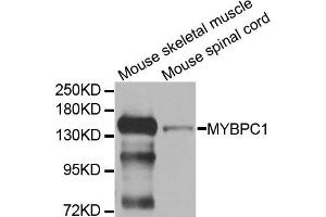 Western blot analysis of extracts of mouse skeletal muscle and mouse spinal cord cell lines, using MYBPC1 antibody.