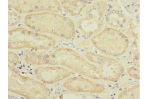 Immunohistochemistry of paraffin-embedded human kidney tissue using ABIN7170165 at dilution of 1:100 (SLC22A8 Antikörper  (AA 473-542))