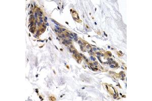 Immunohistochemistry of paraffin-embedded human normal breast using PKLR antibody (ABIN5970989) at dilution of 1/200 (40x lens). (PKLR Antikörper)