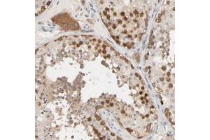 Immunohistochemical staining (Formalin-fixed paraffin-embedded sections) of human testis with MAGEA8 polyclonal antibody  shows strong nuclear and cytoplasmic positivity in cells in seminiferous ducts and strong cytoplasmic positivity in Leydig cells at 1:50-1:200 dilution. (MAGEA8 Antikörper)