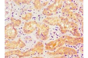 Immunohistochemistry (IHC) image for anti-Activin Receptor Type I (ACRV1) (AA 20-125) antibody (ABIN7143174)