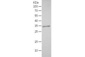 Prosaposin Protein (PSAP) (AA 60-197) (His-IF2DI Tag)