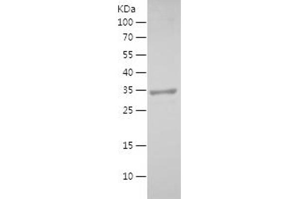 Prosaposin Protein (PSAP) (AA 60-197) (His-IF2DI Tag)