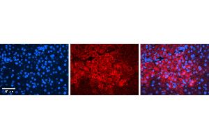 Rabbit Anti-IRF1 Antibody   Formalin Fixed Paraffin Embedded Tissue: Human Liver Tissue Observed Staining: Cytoplasm in hepatocytes Primary Antibody Concentration: 1:100 Other Working Concentrations: 1:600 Secondary Antibody: Donkey anti-Rabbit-Cy3 Secondary Antibody Concentration: 1:200 Magnification: 20X Exposure Time: 0.