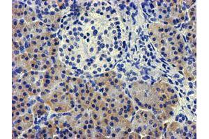 Immunohistochemical staining of paraffin-embedded Human pancreas tissue using anti-LPL mouse monoclonal antibody. (Lipoprotein Lipase Antikörper  (AA 28-475))