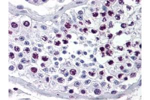 Immunohistochemistry of Rabbit Anti-Cyclin A antibody. (Cyclin A Antikörper)