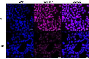 Immunocytochemical staining of HeLa cells using SMARCD1 antibody (ABIN7800480), 1:1,000), Top panel: wild-type (WT), Bottom panal: SMARCD1 shRNA knockdown (KD).