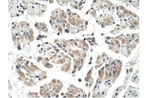 CHST1 antibody was used for immunohistochemistry at a concentration of 4-8 ug/ml to stain Skeletal muscle cells (arrows) in Human Muscle. (CHST1 Antikörper)