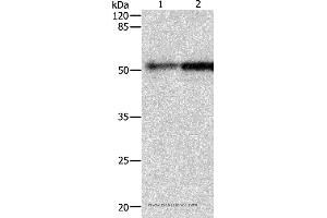 Western blot analysis of Human fetal kidney and lung tissue, using CASP2 Polyclonal Antibody at dilution of 1:950 (Caspase 2 Antikörper)