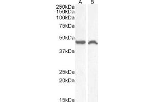 (ABIN190795) (1 μg/mL) staining of HeLa (A) and (0. (TACR1 Antikörper  (Internal Region))