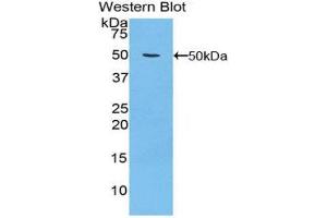 Western Blotting (WB) image for anti-Integrin, alpha 5 (ITGA5) (AA 895-1049) antibody (ABIN1859488) (ITGA5 Antikörper  (AA 895-1049))