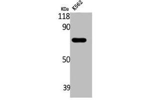 Western Blot analysis of K562 cells using ABCD4 Polyclonal Antibody (ABCD4 Antikörper  (Internal Region))