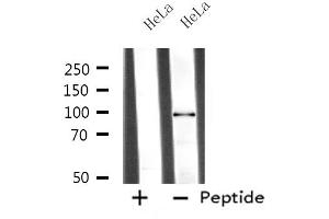 Western blot analysis of extracts from HeLa cells, using MASTL antibody. (MASTL Antikörper  (C-Term))