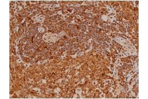 ABIN6256196 and ABIN6267433 at 1/200 staining Rat spleen tissue sections by IHC-P. (Filamin A Antikörper  (pSer2152))