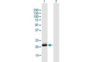 Western Blot analysis of LCN2 expression in transfected 293T cell line by LCN2 MaxPab polyclonal antibody. (Lipocalin 2 Antikörper  (AA 1-198))