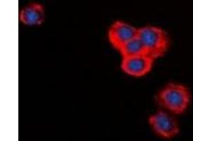 Immunofluorescent analysis of BID staining in RAW264. (BID Antikörper)