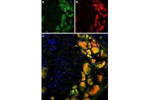 Multiplex staining of TRPV1 and mGluR5 in rat DRG - Immunohistochemical staining of rat dorsal root ganglion using Anti-Rat TRPV1 (VR1) (extracellular)-ATTO Fluor-488 Antibody (ABIN7043839), (1:60) and Anti-mGluR5 (extracellular)-ATTO Fluor-594 Antibody (ABIN7043251), (1:60). (Metabotropic Glutamate Receptor 5 Antikörper  (Extracellular, N-Term) (Atto 594))