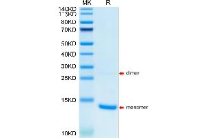 S100A9 Protein (AA 2-114) (His tag)