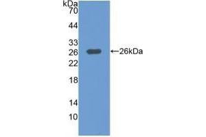 Detection of Recombinant MAP3K1, Human using Polyclonal Antibody to Mitogen Activated Protein Kinase Kinase Kinase 1 (MAP3K1) (MAP3K1 Antikörper  (AA 1307-1509))