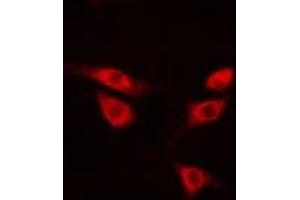 Immunofluorescence (fixed cells) (IF/ICC) image for anti-ATPase, H+ Transporting, Lysosomal 56/58kDa, V1 Subunit B1 (ATP6V1B1) (Internal Region) antibody (ABIN6258486)