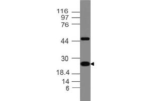Image no. 1 for anti-Adiponectin (ADIPOQ) (AA 40-230) antibody (ABIN5027479) (ADIPOQ Antikörper  (AA 40-230))