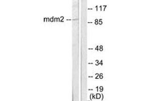Western Blotting (WB) image for anti-Mdm2, p53 E3 Ubiquitin Protein Ligase Homolog (Mouse) (MDM2) (AA 391-440) antibody (ABIN2889224) (MDM2 Antikörper  (AA 391-440))