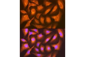 Immunofluorescence analysis of U-2 OS cells using F/UBD Rabbit mAb (ABIN7271134) at dilution of 1:100 (40x lens).