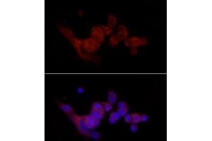 Immunofluorescence analysis of MCF7 cells using SREBF1 Rabbit pAb (ABIN7270598) at dilution of 1:100 (40x lens). (SREBF1 Antikörper  (AA 1-100))