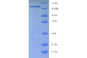 SDS-PAGE (SDS) image for Centrosomal Protein 63kDa (CEP63) (AA 1-495), (full length) protein (His-SUMO Tag) (ABIN5711585)