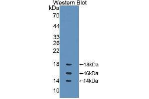 Detection of Recombinant IL15, Rat using Polyclonal Antibody to Interleukin 15 (IL15)